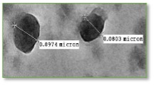 Ca2+ homeostasis and it's role in calcium deposition at the micron level