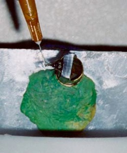 Application of the US with a syringe.