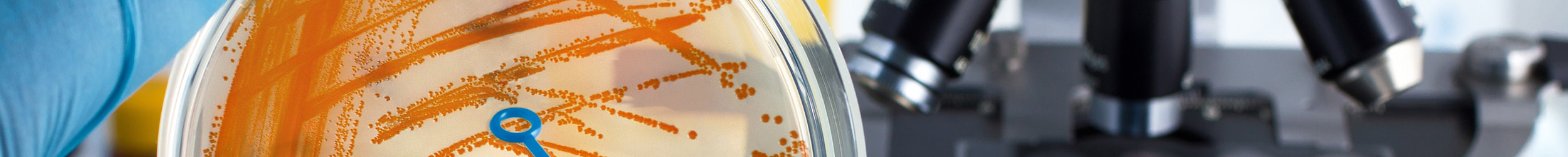 Gloved hand holding petri dish with orange bacteria and loop, microscope in background.
